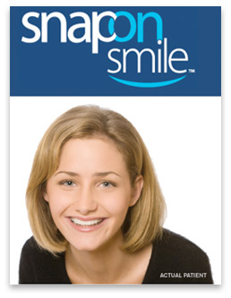 snap on smile Snap on Smile, Affordable Way to Restore Your Smile